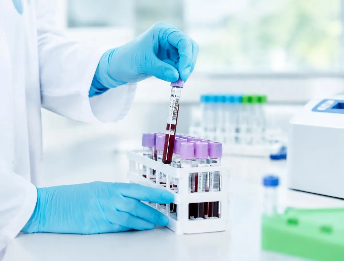 Tubos de muestras en un laboratorio clínico